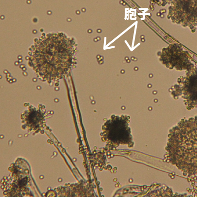 奈良の木の健康効果試験　カビの光学顕微鏡写真
